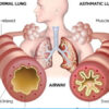 Dr Sanjay Chest Specialist and Diabetologist