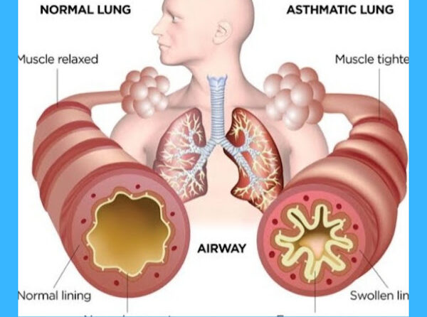 Dr Sanjay Chest Specialist and Diabetologist